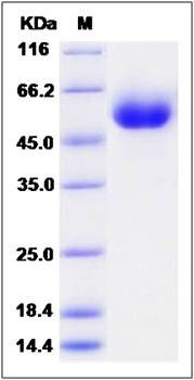 SDS-PAGE analysis of human SMPDL3A protein (His Tag)