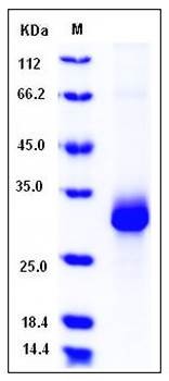 SDS-PAGE analysis of mouse ADIPOQ His tag protein