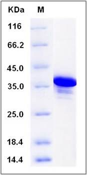 SDS-PAGE analysis of human DYDC2 protein (GST Tag)