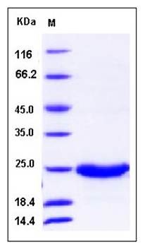 SDS-PAGE analysis of human GM2A protein (His Tag)
