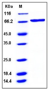 SDS-PAGE analysis of human SGK3 His GST tag protein