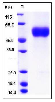 SDS-PAGE analysis of H4N8 HA1 protein (His Tag)
