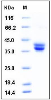 SDS-PAGE analysis of mouse GPA33 His tag protein