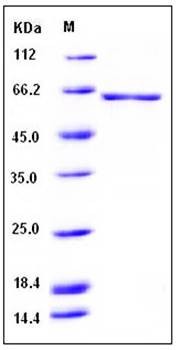 SDS-PAGE analysis of human GAD1 His tag protein