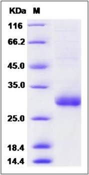 SDS-PAGE analysis of human TMED1 protein (His Tag)