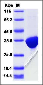 SDS-PAGE analysis of human SBDS protein (His Tag)