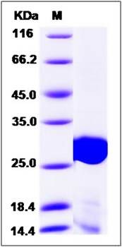 SDS-PAGE analysis of H7N9 M1 protein (His Tag)
