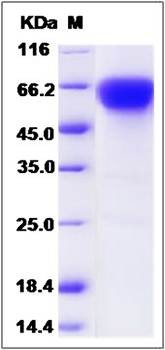 SDS-PAGE analysis of human CD27 protein