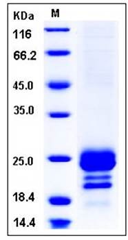 SDS-PAGE analysis of human COQ7 His tag protein
