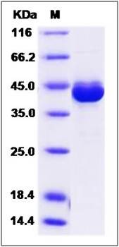 SDS-PAGE analysis of Human GUCA1A protein (GST Tag)