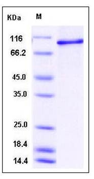 SDS-PAGE analysis of human STAT6 protein (His Tag)