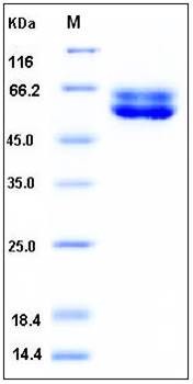 SDS-PAGE analysis of human FUT10 His tag protein