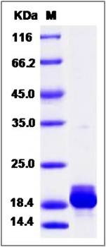 SDS-PAGE analysis of Human RBP7 protein (His Tag)