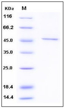 SDS-PAGE analysis of human SMYD3 Flag His tag protein