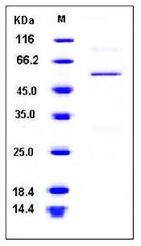 SDS-PAGE analysis of human BLMH His tag protein
