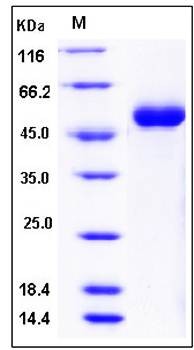 SDS-PAGE analysis of Mouse DDR1 His tag protein