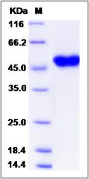 SDS-PAGE analysis of human CRELD1 protein (His Tag)