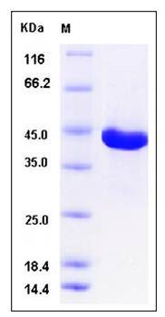 SDS-PAGE analysis of human SERPINB3 protein (His Tag)