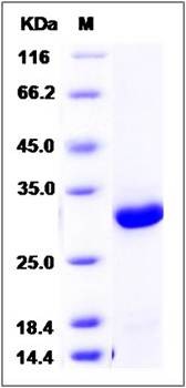SDS-PAGE analysis of human DCXR protein (His Tag)