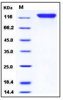 SDS-PAGE analysis of Human OSMR His tag protein