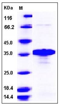 SDS-PAGE analysis of human BNIP3L protein