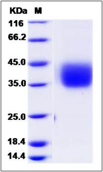 SDS-PAGE analysis of Cynomolgus PROCR protein (His Tag)