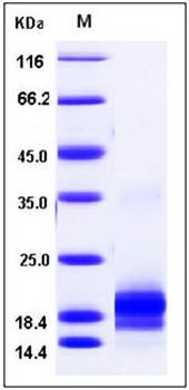 SDS-PAGE analysis of Mouse IL5 protein (His Tag)