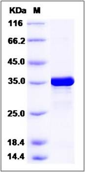 SDS-PAGE analysis of human GALE protein (His Tag)