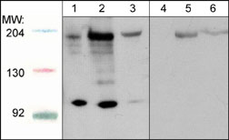 Western blot analysis of HepG2 (lanes 1 & 4), C2C12 (lanes 2 & 5), and HUVEC (lanes 3 & 6). The blot was probed with anti-Robo1 (C-terminal region) in absence (lanes 1-3) or presence of Robo1 (C-terminal region) blocking peptide (RX2795; lanes 4-6).