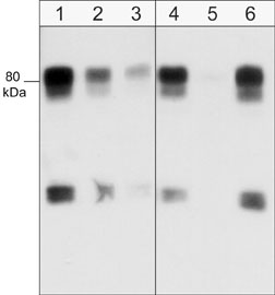 Western blot of human SYF cSrc-transformed cells. Blots were were probed with anti-WAVE1 (N-terminal region) at a dilution of 1:1000 (lane 1), 1:2000 (lane 2) or 1:4000 (lane 3). In addition, the antibody was used in the absence (lane 4) of blocking peptide or in the presence of WAVE1 (N-terminal region) peptide (lane 5) or WAVE2 (Central region) peptide (lane 6).