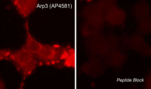 Immunocytochemical labeling of Arp3 in aldehyde-fixed and NP-40-permeabilized rat PC12 cells differentiated with NGF. The cells were labeled with rabbit polyclonal anti-Arp3 (C-terminal region) (AP4581) in the absence (left) or presence (right) of blocking peptide (AX4585). The antibody was detected using appropriate secondary antibody conjugated to DyLight® 594.