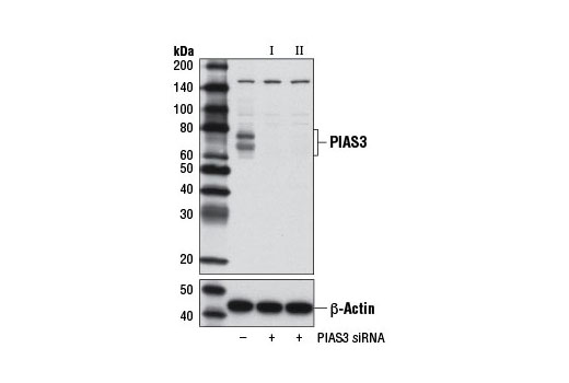 Western blot analysis of extracts from RD cells, transfected with 100 nM SignalSilence ® Control siRNA (Unconjugated) #6568 (-), SignalSilence ® PIAS3 siRNA I #9073 (+), or SignalSilence ® PIAS3 siRNA II (+), using PIAS3 (D5F9) XP ® Rabbit mAb #9042 (upper) or β-Actin (D6A8) Rabbit mAb #8457 (lower). The PIAS3 (D5F9) XP ® Rabbit mAb confirms silencing of PIAS3 expression, while the β-Actin (D6A8) Rabbit mAb is used as a loading control.