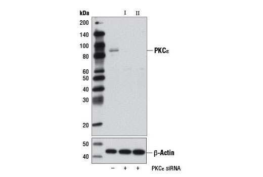 Western blot analysis of extracts from HeLa cells, transfected with 100 nM SignalSilence ® Control siRNA (Unconjugated) #6568 (-), SignalSilence ® PKCε siRNA I (+), or SignalSilence ® PKCε siRNA II #12318 (+), using PKCε (22B10) Rabbit mAb #2683 (upper) or β-Actin (D6A8) Rabbit mAb #8457 (lower). The PKCε (22B10) Rabbit mAb confirms silencing of PKCε expression, while the β-Actin (D6A8) Rabbit mAb is used as a loading control.