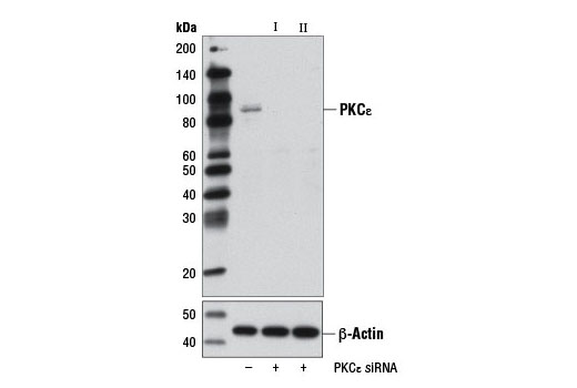 Western blot analysis of extracts from HeLa cells, transfected with 100 nM SignalSilence ® Control siRNA (Unconjugated) #6568 (-), SignalSilence ® PKCε siRNA I #7683 (+), or SignalSilence ® PKCε siRNA II (+), using PKCε (22B10) Rabbit mAb #2683 (upper) or β-Actin (D6A8) Rabbit mAb #8457 (lower). The PKCε (22B10) Rabbit mAb confirms silencing of PKCε expression, while the β-Actin (D6A8) Rabbit mAb is used as a loading control.
