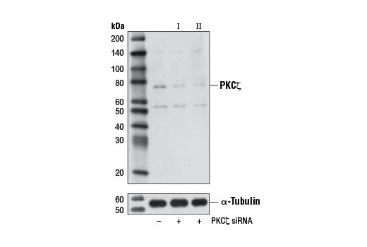 Western blot analysis of extracts from HeLa cells, transfected with 100 nM SignalSilence ® Control siRNA (Unconjugated) #6568 (-), SignalSilence ® PKCζ siRNA I (+), or SignalSilence ® PKCζ siRNA II #8939 (+), using PKCζ (C24E6) Rabbit mAb #9368 (upper) or α-Tubulin (11H10) Rabbit mAb #2125 (lower). The PKCζ (C24E6) Rabbit mAb confirms silencing of PKCζ expression, while the α-Tubulin (11H10) Rabbit mAb is used as a loading control.