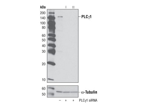Western blot analysis of extracts from HeLa cells, transfected with 100 nM SignalSilence ® Control siRNA (Unconjugated) #6568 (-), SignalSilence ® PLCγ1 siRNA I #6293 (+) or SignalSilence ® PLCγ1 siRNA II (+), using PLCγ1 (D9H10) XP ® Rabbit mAb #5690 (upper) or α-Tubulin (11H10) Rabbit mAb #2125 (lower). The PLCγ1 (D9H10) XP ® Rabbit mAb confirms silencing of PLCγ1 expression, while the α-Tubulin (11H10) Rabbit mAb is used as a loading control.