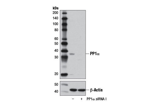 Western blot analysis of extracts from HeLa cells, transfected with 100 nM SignalSilence ® Control siRNA (Unconjugated) #6568 (-) or SignalSilence ® PP1α siRNA I (+), using PP1α Antibody #2582 (upper) or β-Actin (D6A8) Rabbit mAb #8457 (lower). The PP1α Antibody confirms silencing of PP1α expression, while the β-Actin (D6A8) Rabbit mAb is used as a loading control.