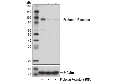 Western blot analysis of extracts from MCF7 cells, transfected with 100 nM SignalSilence ® Control siRNA (Unconjugated) #6568 (-), SignalSilence ® Prolactin Receptor siRNA I #13822 (+), or SignalSilence ® Prolactin Receptor siRNA II (+), using Prolactin Receptor (D4A9) Rabbit mAb #13552 (upper) or β-Actin (D6A8) Rabbit mAb #8457 (lower). The Prolactin Receptor (D4A9) Rabbit mAb confirms silencing of prolactin receptor expression, while the β-Actin (D6A8) Rabbit mAb is used as a loading control.