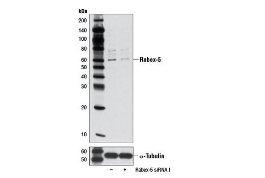 Western blot analysis of extracts from SH-SY5Y cells, transfected with 100 nM SignalSilence ® Control siRNA (Unconjugated) #6568 (-) or SignalSilence ® Rabex-5 siRNA I (+), using Rabex-5 (D21F12) Rabbit mAb #7622 (upper) or α-Tubulin (11H10) Rabbit mAb #2125 (lower). The Rabex-5 (D21F12) Rabbit mAb confirms silencing of Rabex-5 expression, while the α-Tubulin (11H10) Rabbit mAb is used as a loading control.