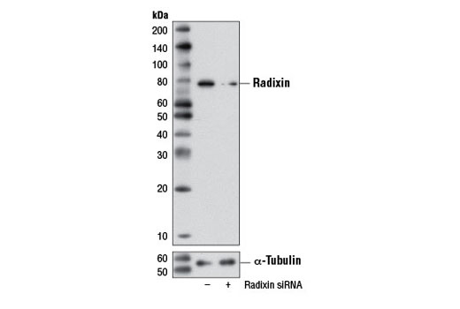 Western blot analysis of extracts from HeLa cells, transfected with 100 nM SignalSilence ® Control siRNA (Unconjugated) #6568 (-) or SignalSilence ® Radixin siRNA I (+), using Radixin (C4G7) Rabbit mAb #2636 and α-Tubulin (11H10) Rabbit mAb #2125. The Radixin (C4G7) Rabbit mAb confirms silencing of radixin expression, while the α-Tubulin (11H10) Rabbit mAb is used as a loading control.