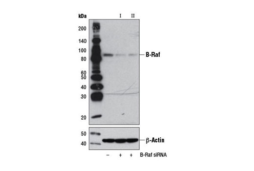 Western blot analysis of extracts from HT-29 cells, transfected with 100 nM SignalSilence ® Control siRNA (Unconjugated) #6568 (-), SignalSilence ® B-Raf siRNA I #8935 (+), or SignalSilence ® B-Raf siRNA II (+), using B-Raf (55C6) Rabbit mAb #9433 (upper) or β-Actin (D6A8) Rabbit mAb #8457 (lower). The B-Raf (55C6) Rabbit mAb confirms silencing of B-Raf expression, while the β-Actin (D6A8) Rabbit mAb is used as a loading control.