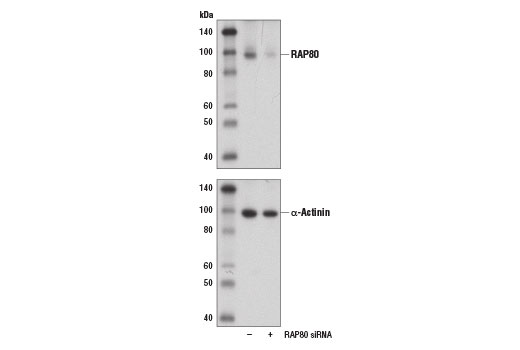 Western blot analysis of extracts from 293T cells, transfected with 100 nM SignalSilence ® Control siRNA (Unconjugated) #6568 (-) or SignalSilence ® RAP80 siRNA I (+), using RAP80 (D1T6Q) Rabbit mAb #14466 (upper) and α-Actinin (D6F6) XP ® Rabbit mAb #6487 (lower). The RAP80 (D1T6Q) Rabbit mAb confirms silencing of RAP80 expression, while the α-Actinin (D6F6) XP ® Rabbit mAb is used as a loading control.