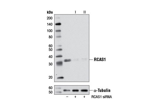 Western blot analysis of extracts from HeLa cells, transfected with 100 nM SignalSilence ® Control siRNA (Unconjugated) #6568 (-), SignalSilence ® RCAS1 siRNA I (+) or SignalSilence ® RCAS1 siRNA II #6496 (+), using RCAS1 Antibody #6960 (upper) or α-Tubulin (11H10) Rabbit mAb #2125 (lower). The RCAS1 Antibody confirms silencing of RCAS1 expression, while the α-Tubulin (11H10) Rabbit mAb is used as a loading control.