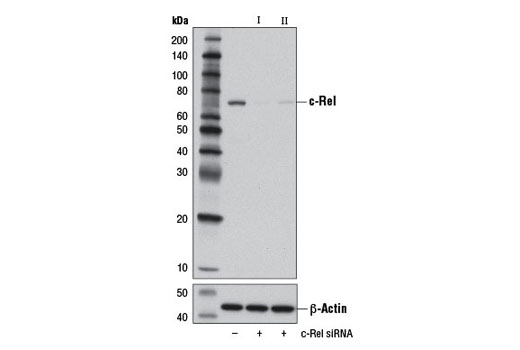 Western blot analysis of extracts from Neuro-2a cells, transfected with 100 nM SignalSilence ® Control siRNA (Unconjugated) #6568 (-), SignalSilence ® c-Rel siRNA I (Mouse Specific) #13058 (+) or SignalSilence ® c-Rel siRNA II (Mouse Specific) (+), using c-Rel (D4Y6M) Rabbit mAb #12707 (upper) or β-Actin (D6A8) Rabbit mAb #8457 (lower). The c-Rel (D4Y6M) Rabbit mAb confirms silencing of c-Rel expression, while the β-Actin (D6A8) Rabbit mAb is used as a loading control.