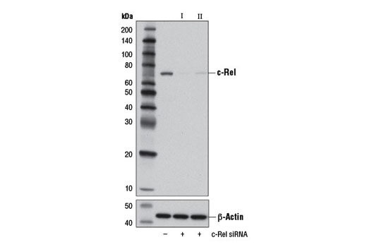 Western blot analysis of extracts from Neuro2A cells, transfected with 100 nM SignalSilence ® Control siRNA (Unconjugated) #6568 (-), SignalSilence ® c-Rel siRNA I (Mouse Specific) (+) or SignalSilence ® c-Rel siRNA II (Mouse Specific) #13170 (+), using c-Rel (D4Y6M) Rabbit mAb #12707 (upper) or β-Actin (D6A8) Rabbit mAb #8457 (lower). The c-Rel (D4Y6M) Rabbit mAb confirms silencing of c-Rel expression, while the β-Actin (D6A8) Rabbit mAb is used as a loading control.