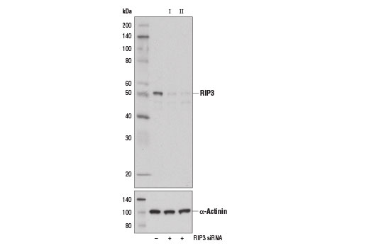 Western blot analysis of extracts from L-929 cells, transfected with 100 nM SignalSilence ® Control siRNA (Unconjugated) #6568 (-), SignalSilence ® RIP3 siRNA I (Mouse Specific) (+), or SignalSilence ® RIP3 siRNA II (Mouse Specific) #14661 (+), using RIP3 Antibody (Rodent Specific) #14401 (upper) and α-Actinin (D6F6) XP ® Rabbit mAb #6487 (lower). The RIP3 Antibody (Rodent Specific) confirms silencing of RIP3 expression, while the α-Actinin (D6F6) XP ® Rabbit mAb is used as a loading control.