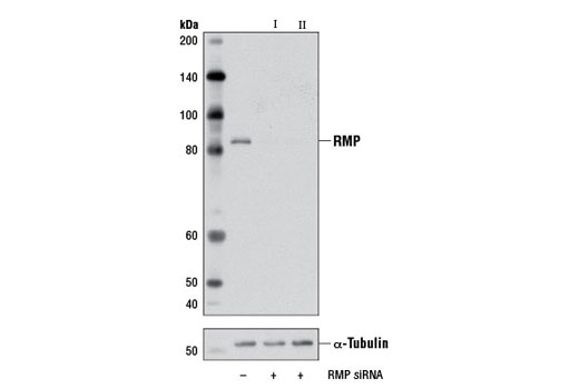 Western blot analysis of extracts from HeLa cells, transfected with 100 nM SignalSilence ® Control siRNA (Unconjugated) #6568 (-), SignalSilence ® RMP siRNA I (+) or SignalSilence ® RMP siRNA II #6495 (+), using RMP Antibody #5844 (upper) or α-Tubulin (11H10) Rabbit mAb #2125 (lower). The RMP Antibody confirms silencing of RMP expression, while the α-Tubulin (11H10) Rabbit mAb is used as a loading control.
