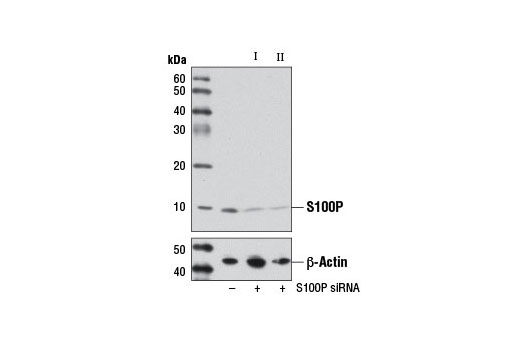 Western blot analysis of extracts from MCF7 cells, transfected with 100 nM SignalSilence ® Control siRNA (Unconjugated) #6568 (-), SignalSilence ® S100P siRNA I (+), or SignalSilence ® S100P siRNA II #12114 (+), using S100P Antibody #7677 (upper) or β-Actin (D6A8) Rabbit mAb #8457 (lower). The S100P Antibody confirms silencing of S100P expression, while the β-Actin (D6A8) Rabbit mAb is used as a loading control.