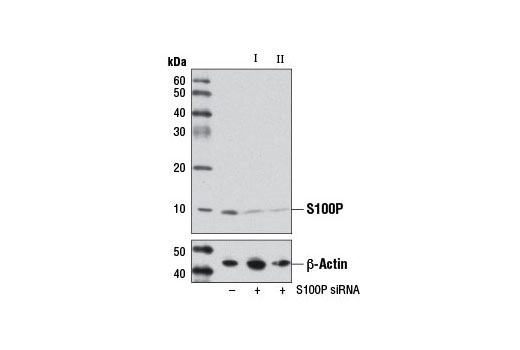 Western blot analysis of extracts from MCF7 cells, transfected with 100 nM SignalSilence ® Control siRNA (Unconjugated) #6568 (-), SignalSilence ® S100P siRNA I #12118 (+), or SignalSilence ® S100P siRNA II (+), using S100P Antibody #7677 (upper) or β-Actin (D6A8) Rabbit mAb #8457 (lower). The S100P Antibody confirms silencing of S100P expression, while the β-Actin (D6A8) Rabbit mAb is used as a loading control.
