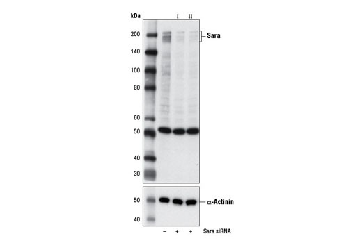 Western blot analysis of extracts from SH-SY-5Y cells, transfected with 100 nM SignalSilence ® Control siRNA (Unconjugated) #6568 (-), SignalSilence ® Sara siRNA I #13542 (+) or SignalSilence ® Sara siRNA II (+), using Sara (D5X4F) Rabbit mAb #13285 (upper) or α-Actinin (D6F6) XP ® Rabbit mAb #6487 (lower). The Sara (D5X4F) Rabbit mAb confirms silencing of Sara expression, while the α-Actinin (D6F6) XP ® Rabbit mAb is used as a loading control.